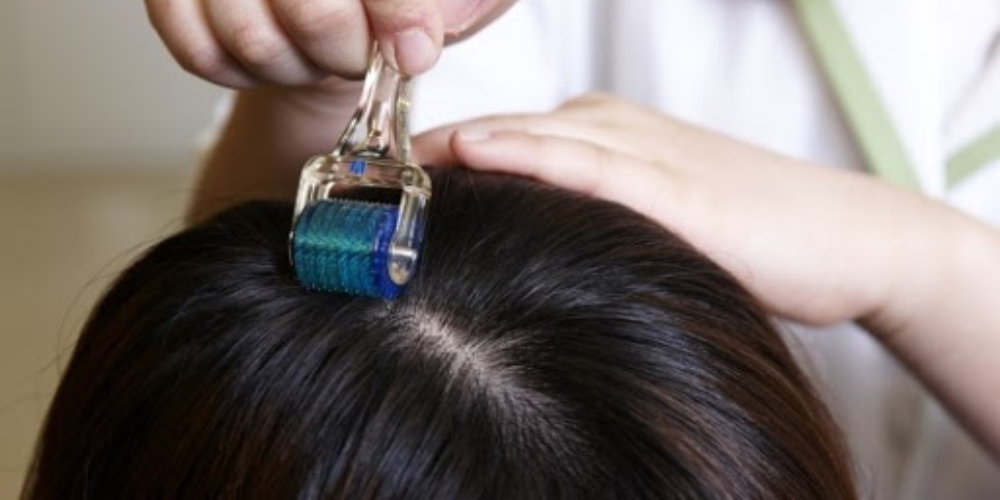 the-health-problems-of-bad-hair-homeopathy-treatment-panvel